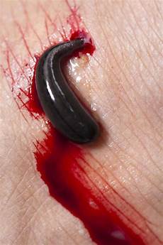 Leaches