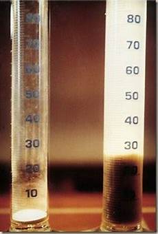 Soil Preparation